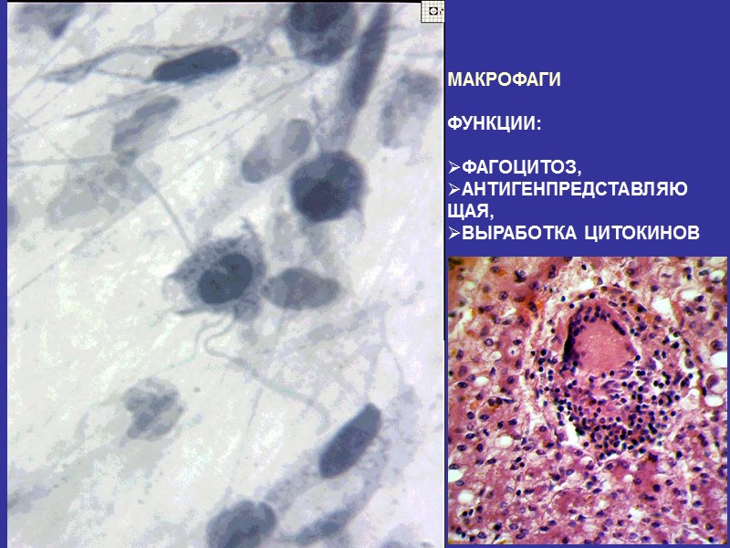 МАКРОФАГИ  ФУНКЦИИ:  ФАГОЦИТОЗ, АНТИГЕНПРЕДСТАВЛЯЮЩАЯ, ВЫРАБОТКА ЦИТОКИНОВ